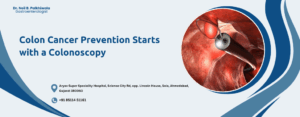 Colon Cancer Prevention Starts with Colonoscopy
