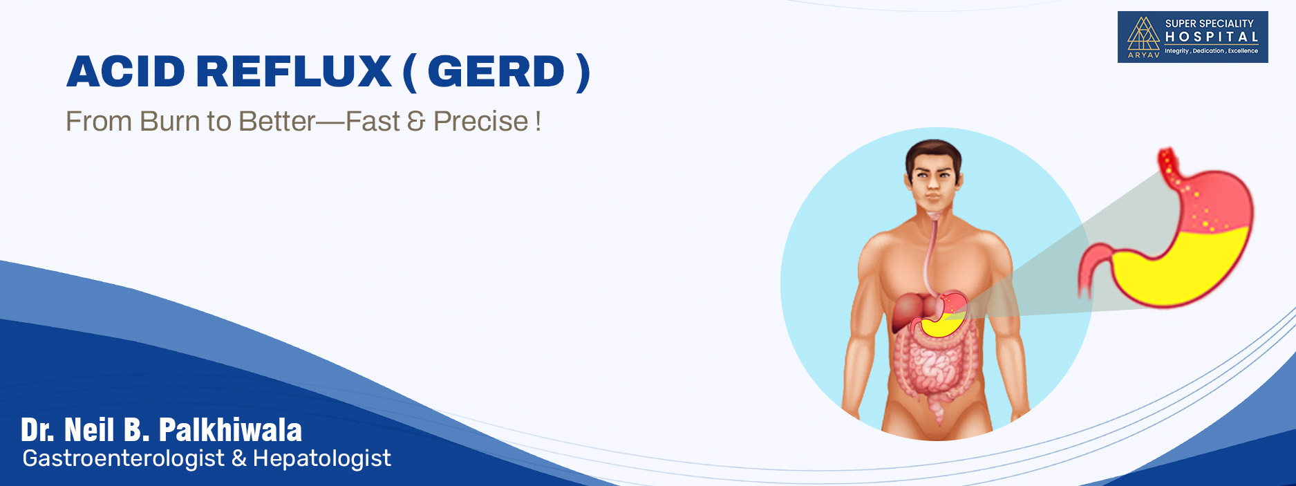 Acid-Reflux-(GERD)